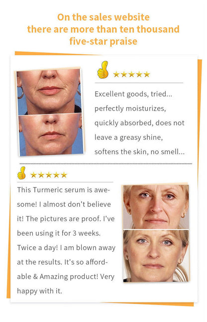 Beauty Products Sale Turmeric Darkspot Corrector Serum,Turmeric Serum for Darkspot,Turmeric Oil for Acne,Dark Spots, Hyperpigmentation,Smooth Skin,Fine Lines and Wrinkles30Ml